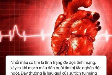 Trước khi bị nhồi máu cơ tim, cơ thể sẽ xuất hiện ‘1 nóng’, ‘2 đau’, ‘3 nhiều’