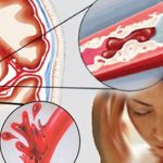 5 dấu hiệu vàng cho thấy bạn sở hữu dòng máu “sạch” và hệ tuần hoàn khỏe mạnh