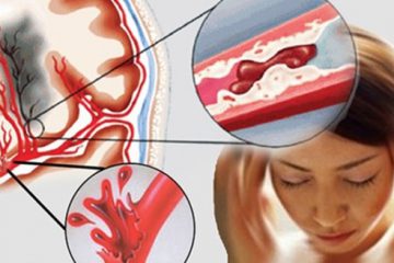 5 dấu hiệu vàng cho thấy bạn sở hữu dòng máu “sạch” và hệ tuần hoàn khỏe mạnh